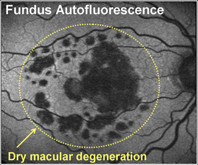 Ophthalmologist in Los Angeles