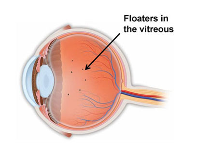 Ophthalmologist in Los Angeles