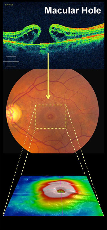 Retinal Specialist in Los Angeles
