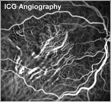 Ophthalmologist in Los Angeles