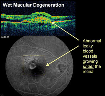 Ophthalmologist in Los Angeles