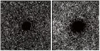 Retinal Specialist in Los Angeles