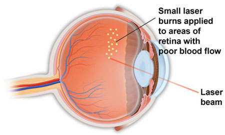 Ophthalmologist in Los Angeles