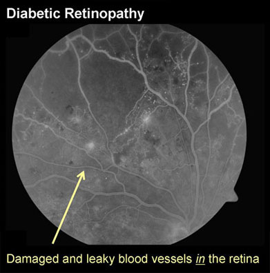 Ophthalmologist in Los Angeles