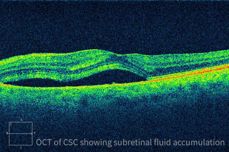 Ophthalmologist in Los Angeles