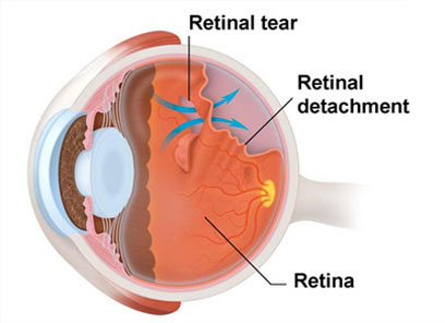 Ophthalmologist in Los Angeles
