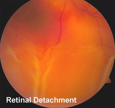 Eye Doctor in Los Angeles