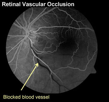 Eye Doctor in Los Angeles