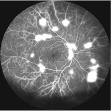 Eye Doctor in Los Angeles